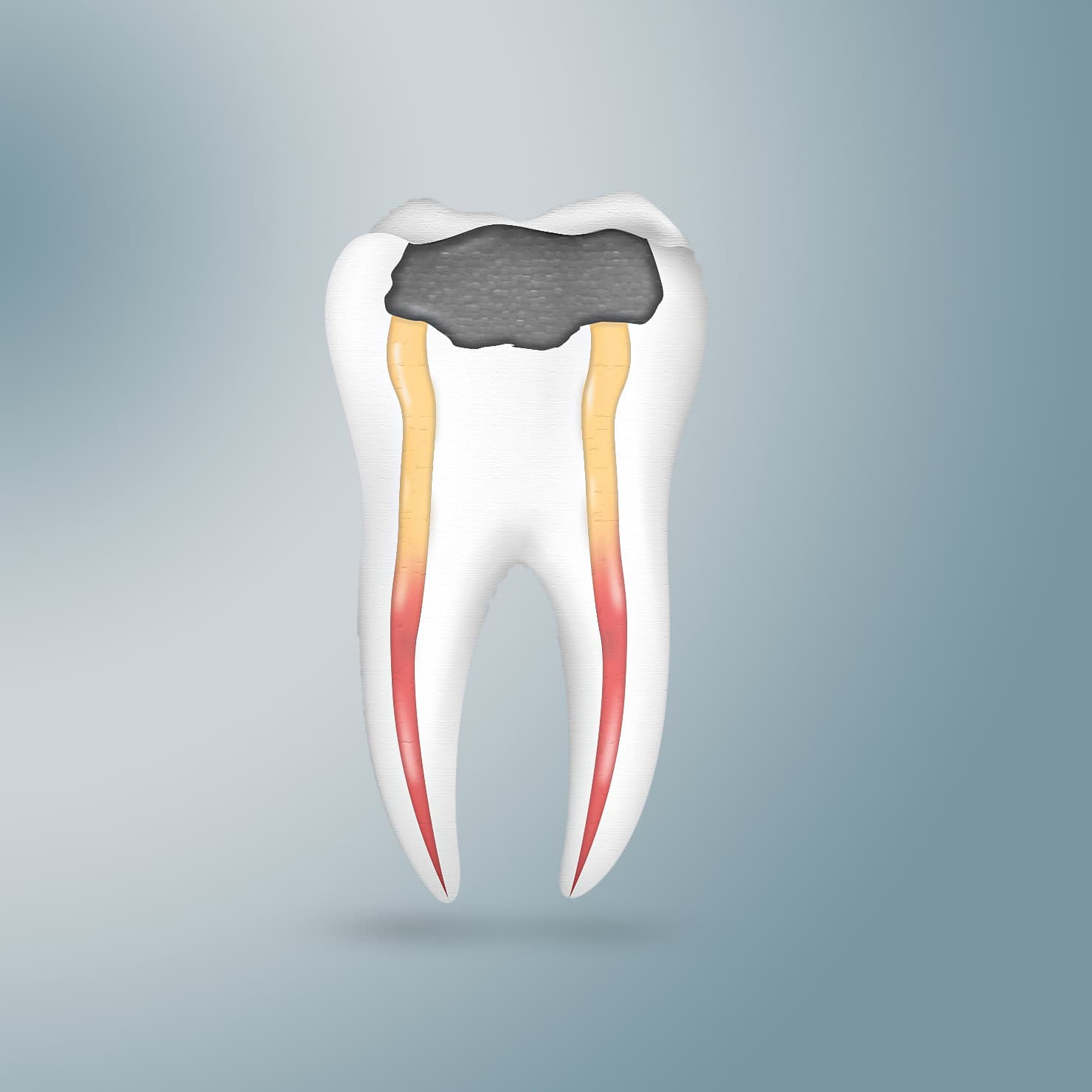 procedure